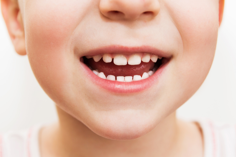 Close-up of a child smiling, showcasing clean, white teeth. The background is neutral, highlighting the joyful expression and dental health.